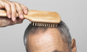 Choosing A Medication For Hair Regrowth – Which Is Right For Me?